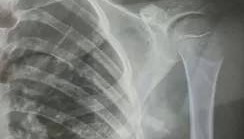 赤峰市教育局介入，家长称：孩子拨弄开关被另一班班主任打伤